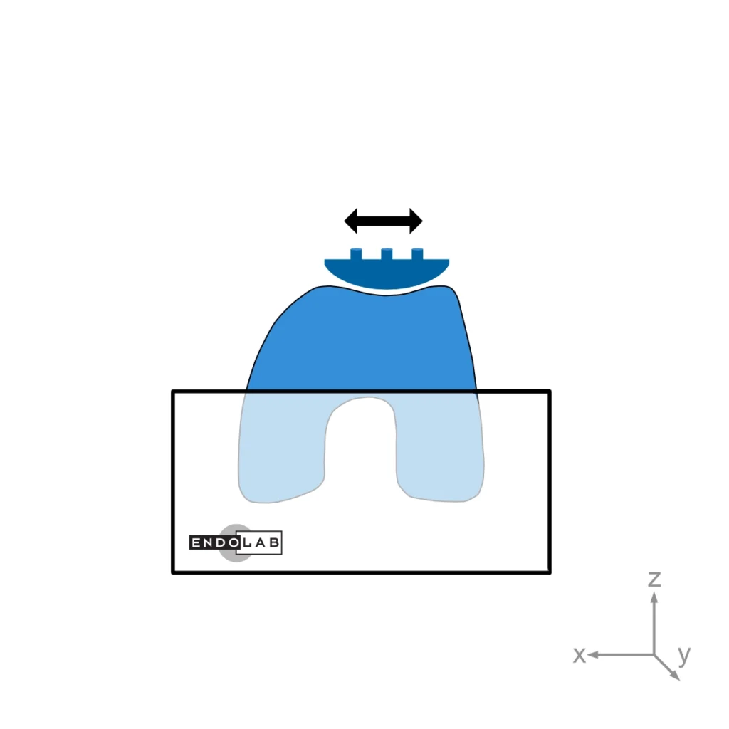 Schematic of a test according to ASTM F1672 in loading direction dislocation resistance